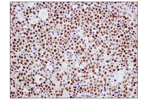 Immunohistochemistry Image 3: TRIM33 (D7U4F) Rabbit mAb