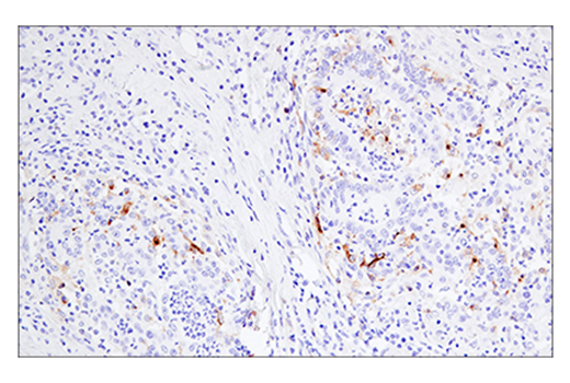 Immunohistochemistry Image 2: 4-1BB/CD137/TNFRSF9 (E6Z7F) XP<sup>®</sup> Rabbit mAb