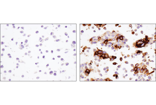 Immunohistochemistry Image 3: PD-1 (Intracellular Domain) (D4W2J) XP<sup>®</sup> Rabbit mAb