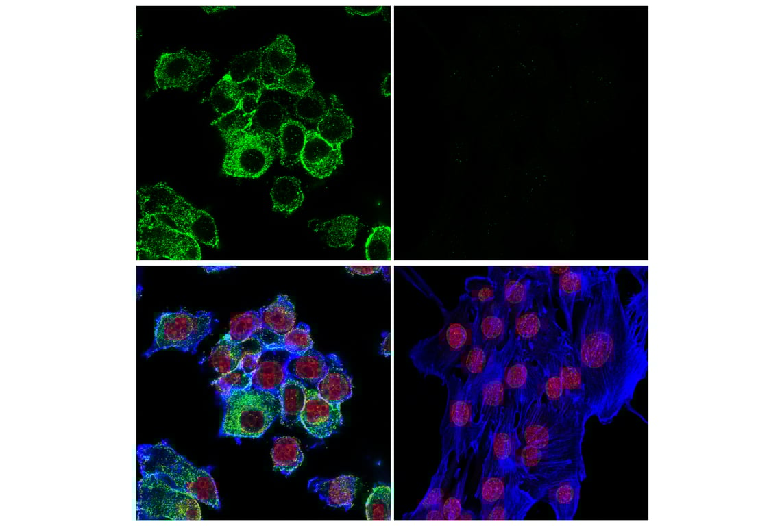 Immunofluorescence Image 1: CD11b/ITGAM (E6E1M) Rabbit mAb