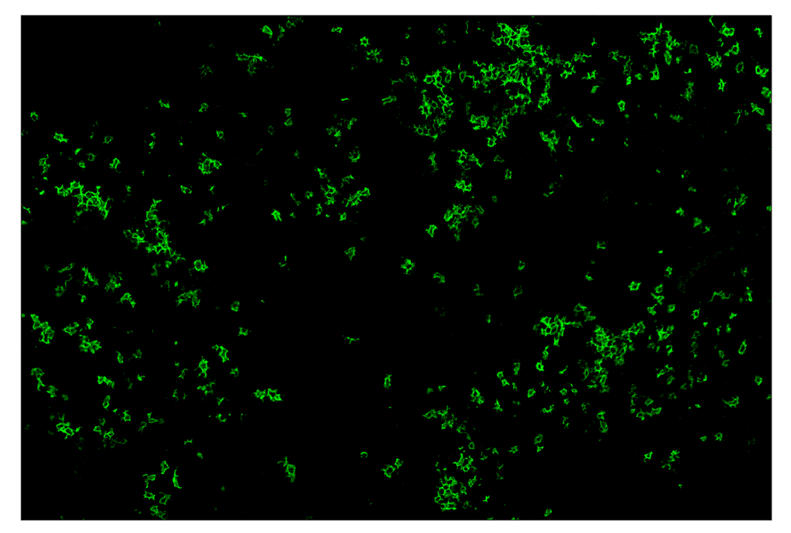 Immunohistochemistry Image 2: CD20 (E3N7O) & CO-0134-750 SignalStar<sup>™</sup> Oligo-Antibody Pair