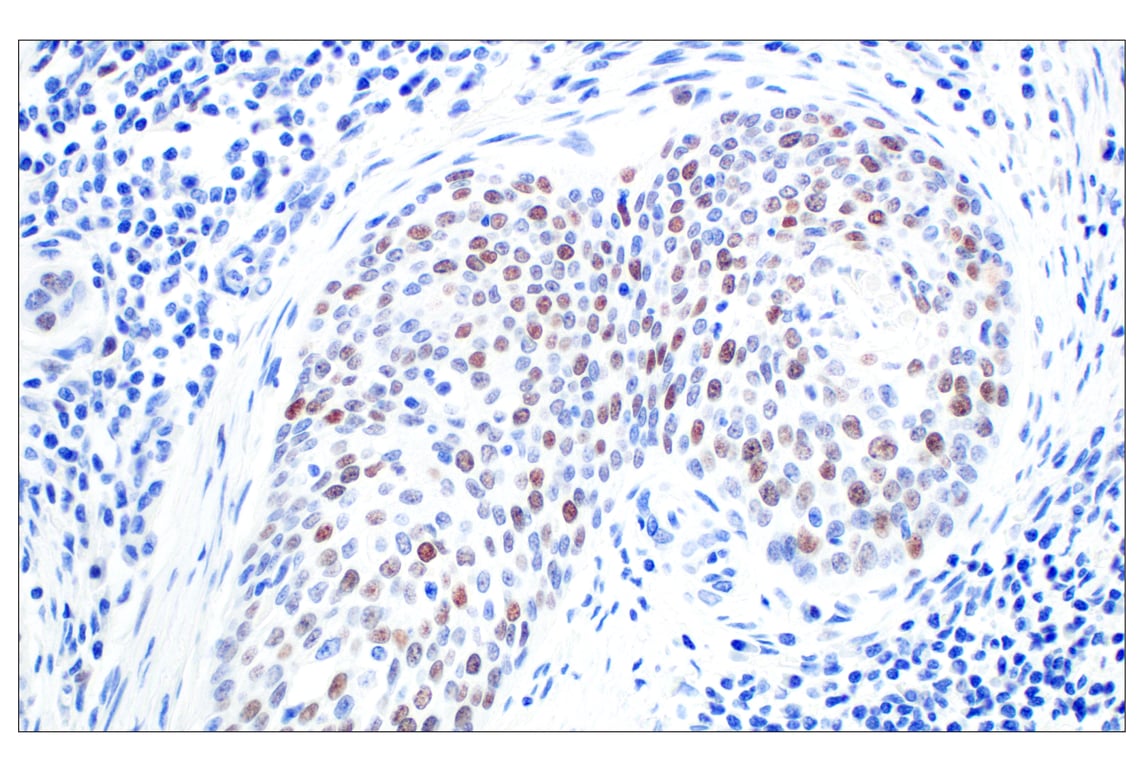 Immunohistochemistry Image 2: BRCA1 (E5S9G) Rabbit mAb