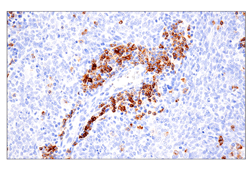 Immunohistochemistry Image 3: CD22 (E7L6Z) XP<sup>®</sup> Rabbit mAb (BSA and Azide Free)