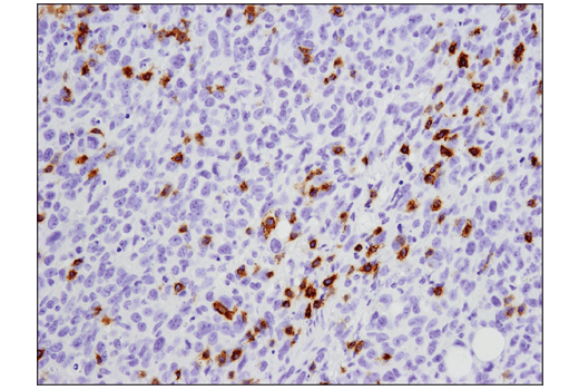 Immunohistochemistry Image 1: PD-1 (Intracellular Domain) (D7D5W) XP<sup>®</sup> Rabbit mAb