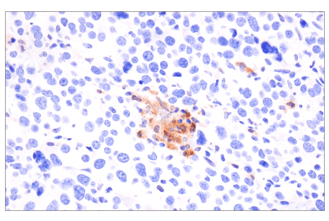 undefined Image 3: Mouse Reactive Pyroptosis Antibody Sampler Kit
