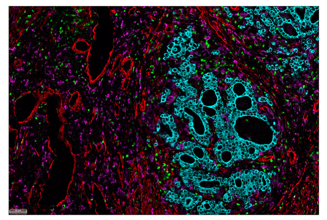 Immunohistochemistry Image 7: Tox/Tox2 (E6I3Q) & CO-0016-750 SignalStar<sup>™</sup> Oligo-Antibody Pair