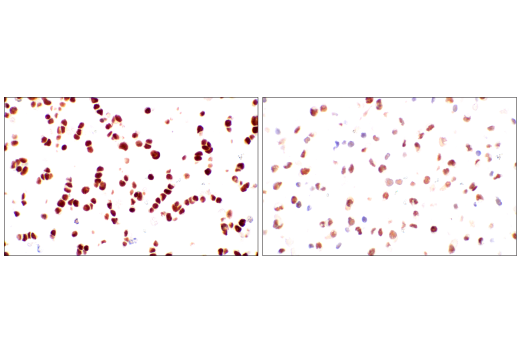 Immunohistochemistry Image 14: METTL14 (E2G9A) Rabbit mAb