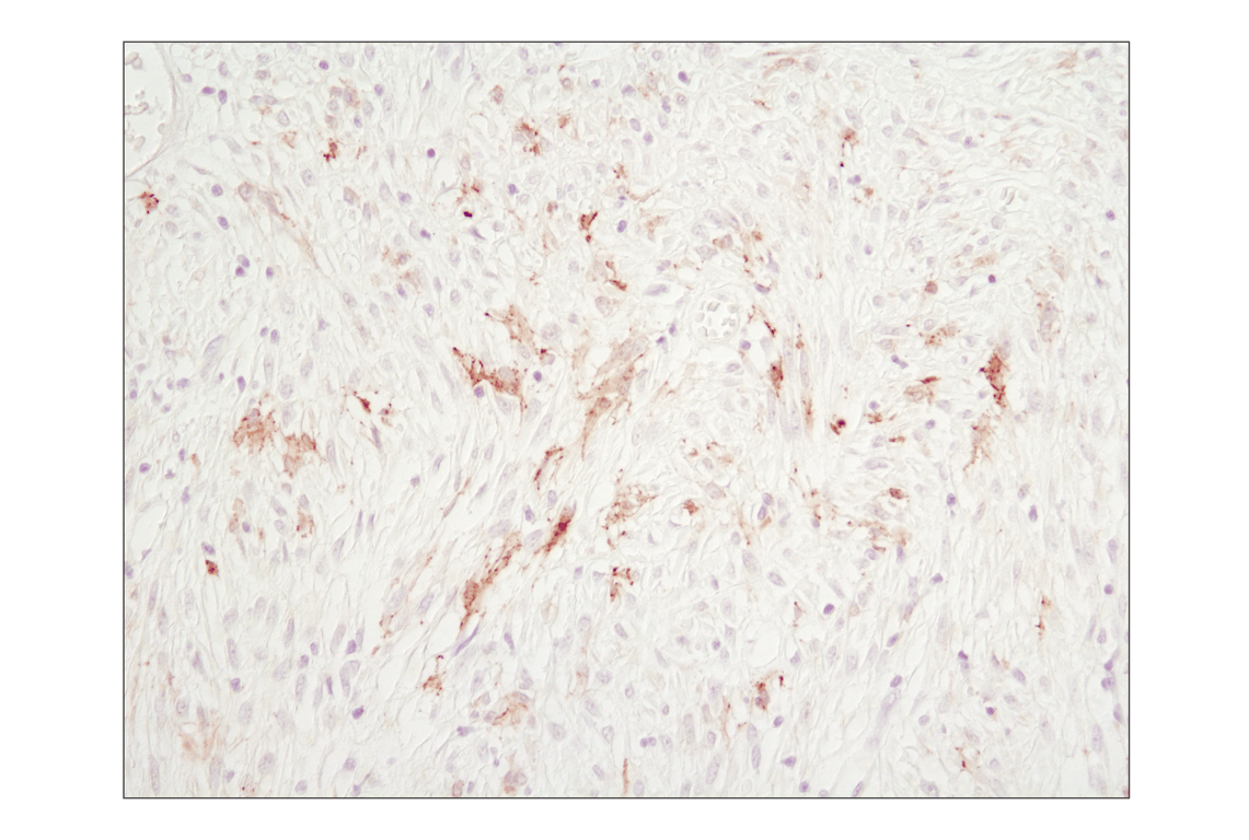 Immunohistochemistry Image 3: Cleaved Caspase-3 (Asp175) (D3E9) Rabbit mAb