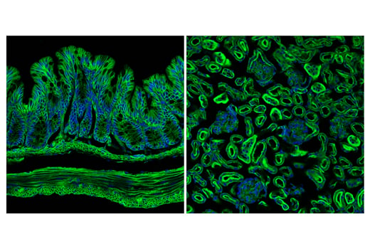 Immunofluorescence Image 2: Ras (E4K9L) Rabbit mAb