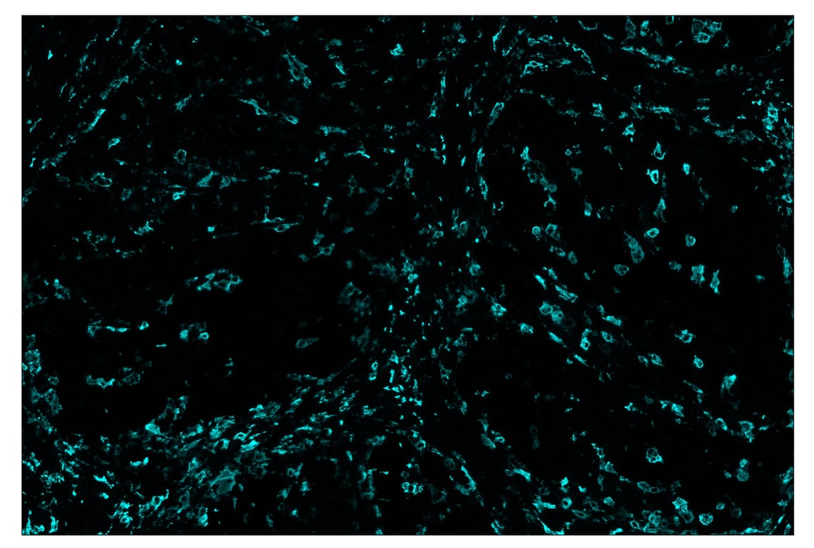 Immunohistochemistry Image 5: CD163 (D6U1J) & CO-0022-647 SignalStar<sup>™</sup> Oligo-Antibody Pair