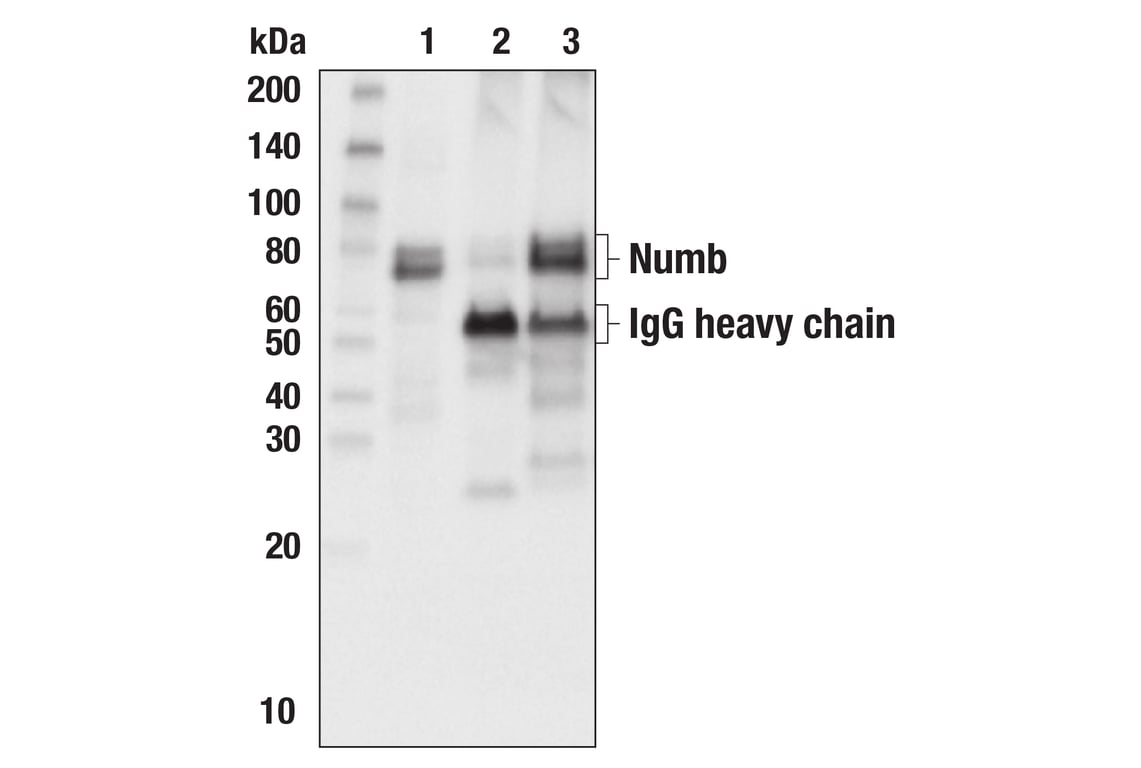 Immunoprecipitation Image 1: Numb (C29G11) Rabbit mAb