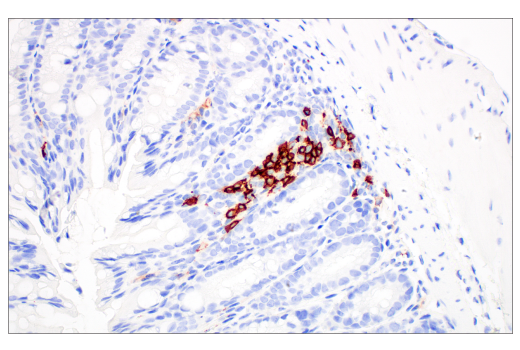 Immunohistochemistry Image 1: CD20 (E3N7O) XP<sup>®</sup> Rabbit mAb