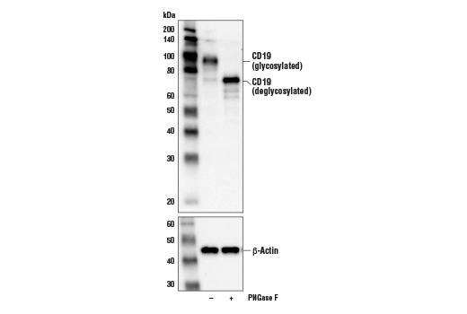 Western Blotting Image 2: CD19 (Intracellular Domain) (D4V4B) XP<sup>®</sup> Rabbit mAb