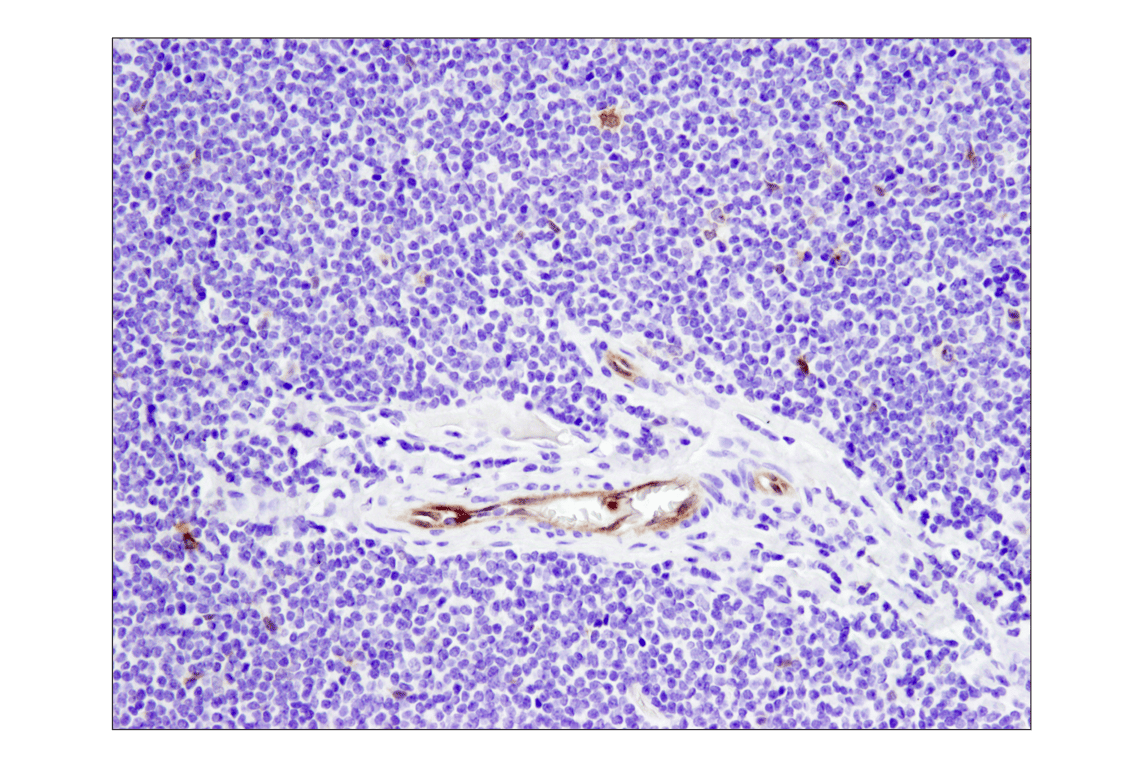 Immunohistochemistry Image 4: TNFRSF8/CD30 (E4L4I) XP<sup>®</sup> Rabbit mAb (BSA and Azide Free)