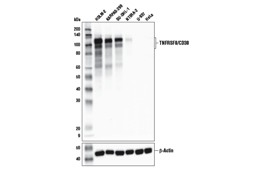 Western Blotting Image 2: TNFRSF8/CD30 (E7E4D) XP<sup>®</sup> Rabbit mAb (BSA and Azide Free)