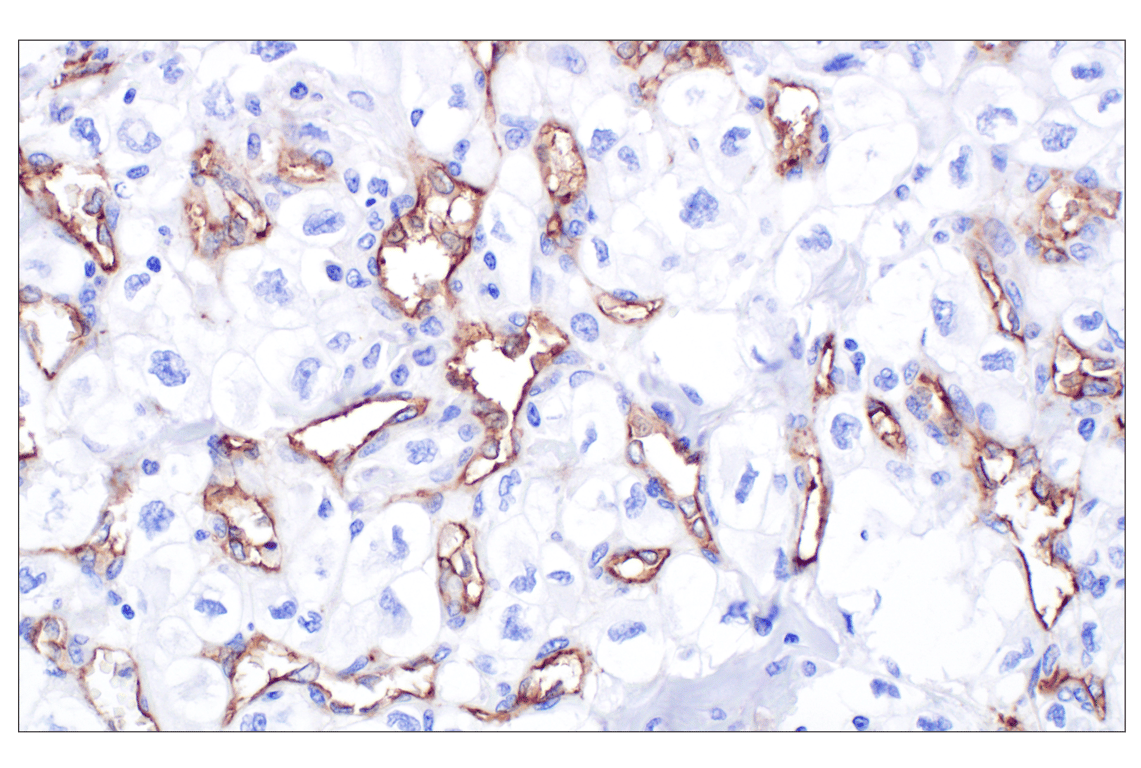 Immunohistochemistry Image 3: CD105/Endoglin (F9C5Q) Rabbit mAb