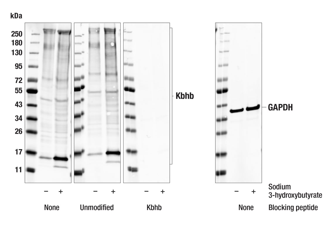 Western Blotting Image 2: β-Hydroxybutyryl Lysine (E6H5Q) Rabbit mAb