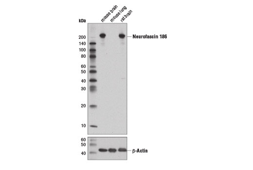 undefined Image 1: Demyelinating Disease Targets Antibody Sampler Kit