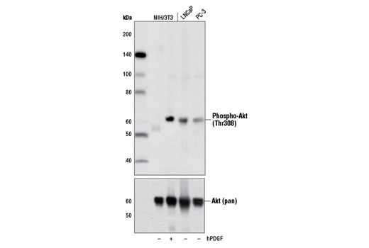 AS160 Signaling Antibody Sampler Kit: Image 1