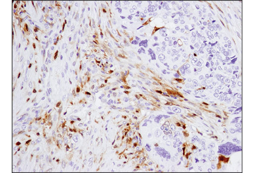 Immunohistochemistry Image 3: Galectin-9 (D9R4A) XP<sup>®</sup> Rabbit mAb (BSA and Azide Free)