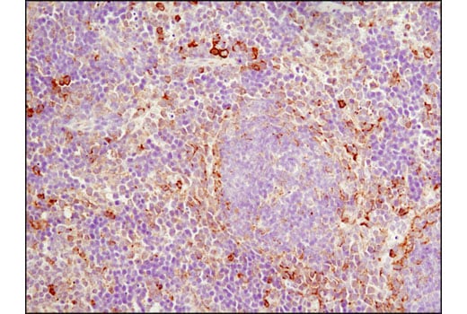 undefined Image 19: Organelle Localization IF Antibody Sampler Kit