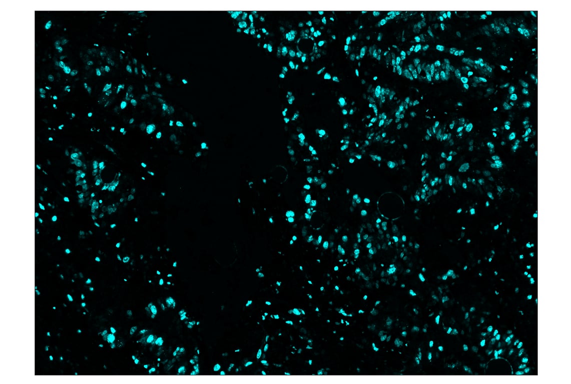 Immunohistochemistry Image 5: Ki-67 (8D5) & CO-0014-647 SignalStar<sup>™</sup> Oligo-Antibody Pair