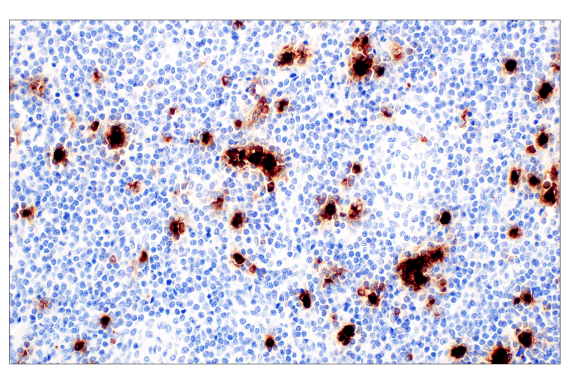 Immunohistochemistry Image 2: Neutrophil Elastase (F4H3X) Rabbit mAb (BSA and Azide Free)