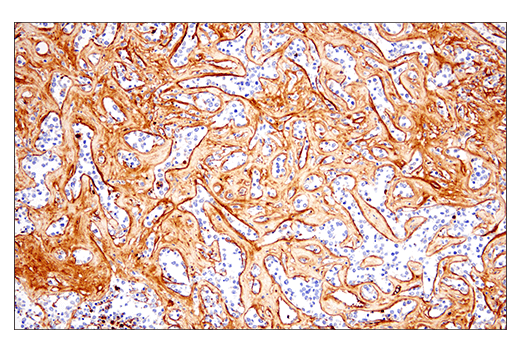 undefined Image 54: Extracellular Matrix Dynamics Antibody Sampler Kit