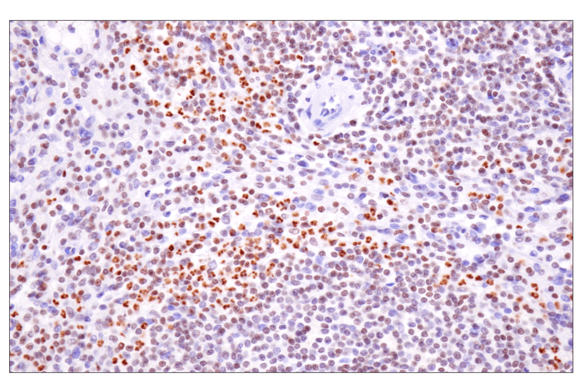 Immunohistochemistry Image 6: Acetyl-Histone H4 (Lys16) (E2B8W) Rabbit mAb