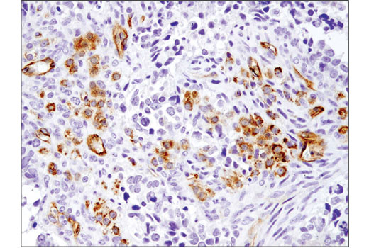 Immunohistochemistry Image 3: ABCG2 (D5V2K) XP<sup>®</sup> Rabbit mAb (BSA and Azide Free)