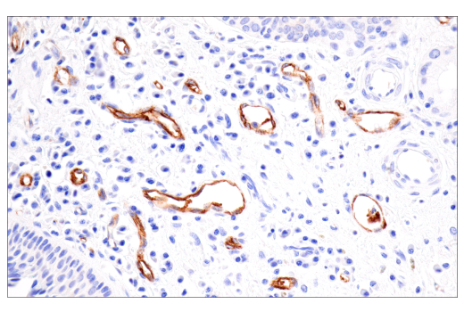 Immunohistochemistry Image 1: CD62P/P-Selectin (E8Q1W) XP<sup>®</sup> Rabbit mAb (BSA and Azide Free)
