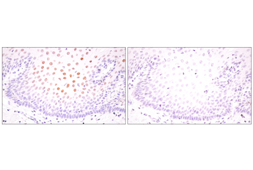 Immunohistochemistry Image 8: HIF-1α (E1V6A) Rabbit mAb