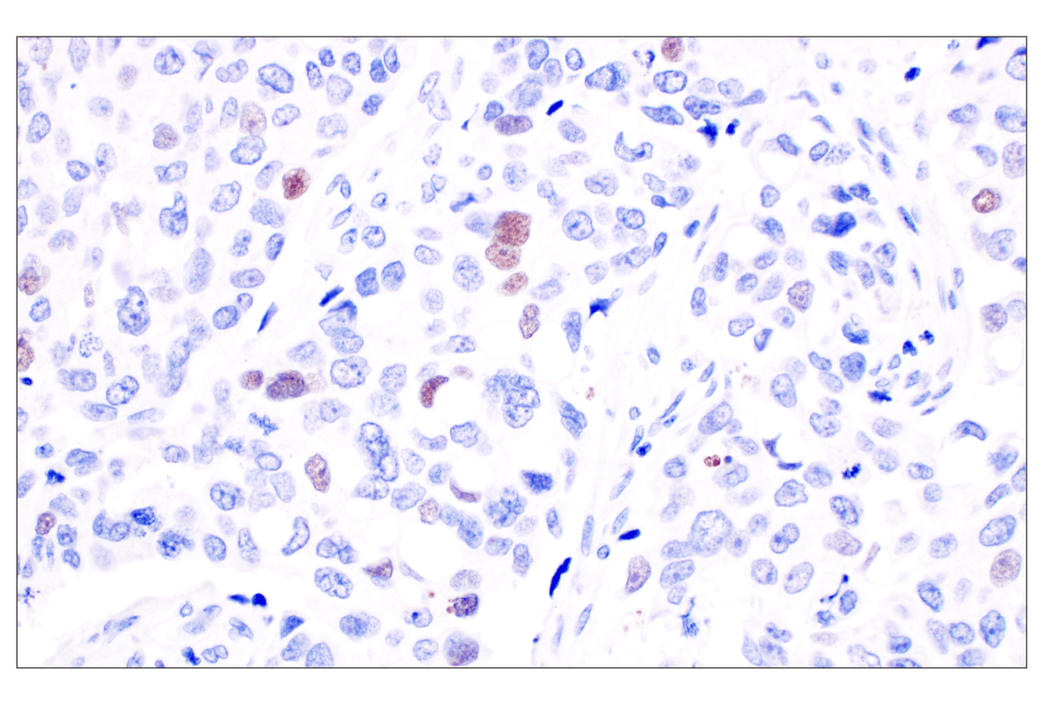 undefined Image 16: Non-Homologous End Joining (NHEJ) DNA Repair Antibody Sampler Kit