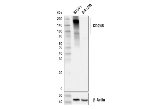 Western Blotting Image 1: CD248 (E9Z7O) XP<sup>®</sup> Rabbit mAb