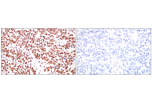 Immunohistochemistry Image 13: METTL14 (E2G9A) Rabbit mAb