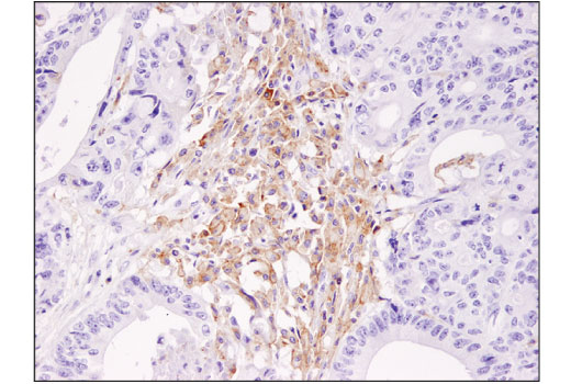 undefined Image 44: Human Exhausted CD8<sup>+</sup> T Cell IHC Antibody Sampler Kit