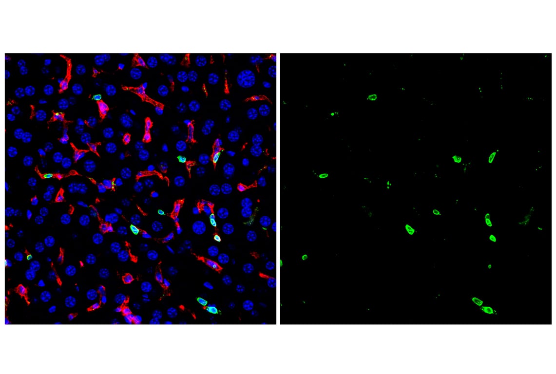 Immunofluorescence Image 1: CD20 (E3N7O) XP<sup>®</sup> Rabbit mAb