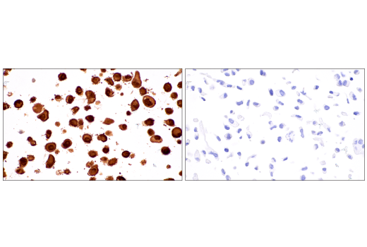 Immunohistochemistry Image 10: S100B (E7C3A) Rabbit mAb