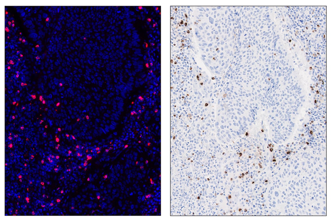 Immunohistochemistry Image 6: Granzyme B (D6E9W) & CO-0009-488 SignalStar<sup>™</sup> Oligo-Antibody Pair