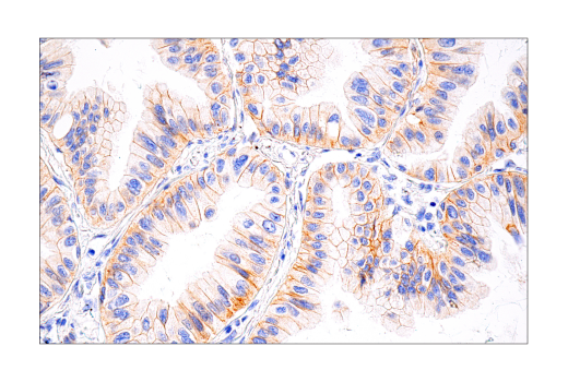 undefined Image 54: Lung Cancer RTK Antibody Sampler Kit