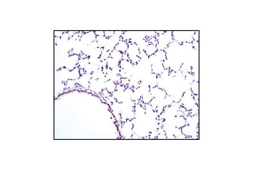 undefined Image 48: Cannabinoid Receptor 1 Downstream Signaling Antibody Sampler Kit