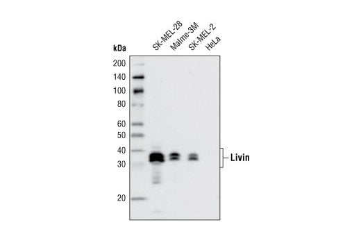 Western Blotting Image 1: Livin (D61D1) XP<sup>®</sup> Rabbit mAb