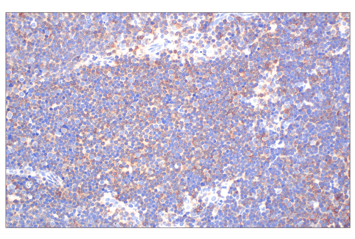 Immunohistochemistry Image 5: CD27 (F3R2V) Rabbit mAb