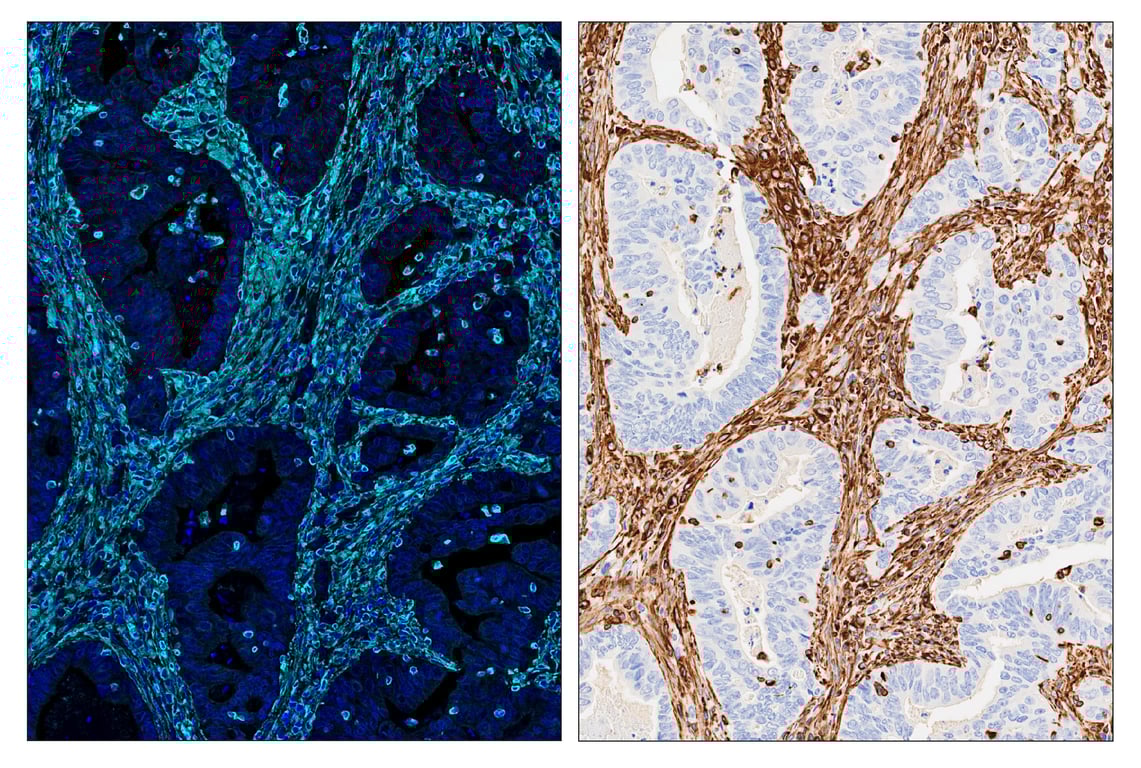 Immunohistochemistry Image 6: Vimentin (D21H3) & CO-0012-647 SignalStar<sup>™</sup> Oligo-Antibody Pair