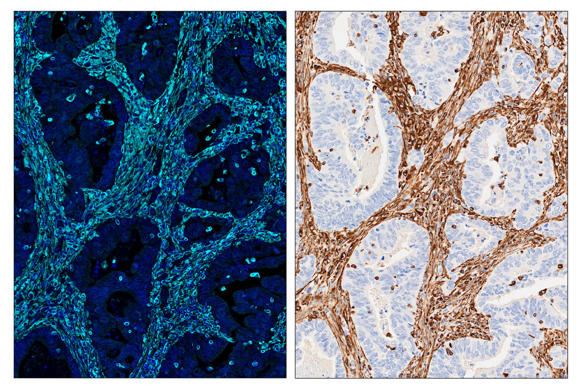 Immunohistochemistry Image 6: Vimentin (D21H3) & CO-0012-647 SignalStar<sup>™</sup> Oligo-Antibody Pair