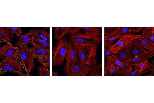 undefined Image 13: PhosphoPlus<sup>®</sup> β-Catenin (Ser675) Antibody Duet
