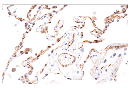Immunohistochemistry Image 4: CD109 (E4I2V) Rabbit mAb (BSA and Azide Free)