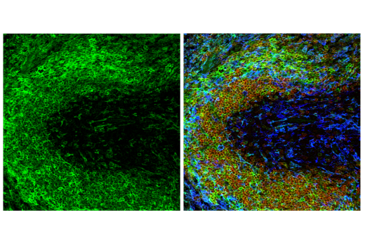 Immunofluorescence Image 1: CD38 (E9F5A) XP<sup>®</sup> Rabbit mAb