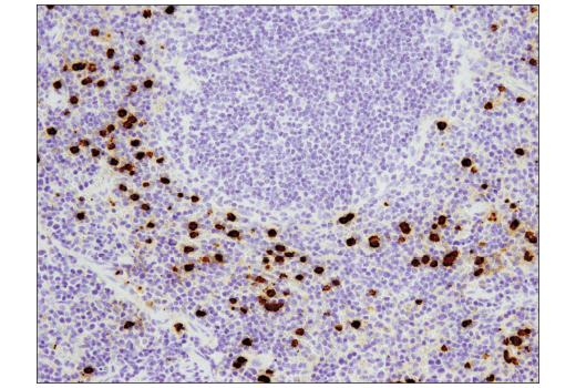 Immunohistochemistry Image 2: S100A9 (D3U8M) Rabbit mAb
