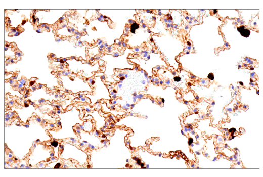 Immunohistochemistry Image 8: Galectin-3/LGALS3 (E7B6R) Rabbit mAb